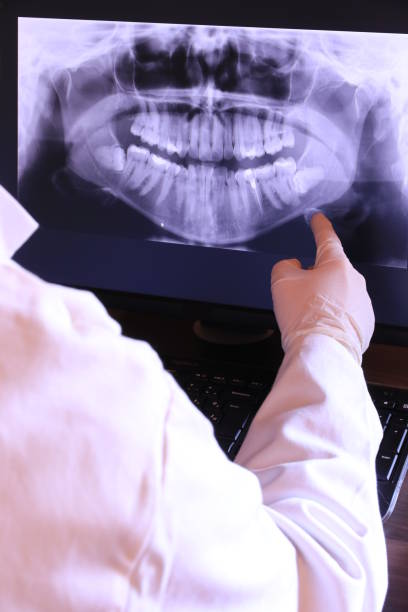 Best Emergency Tooth Extraction in Atchison, KS